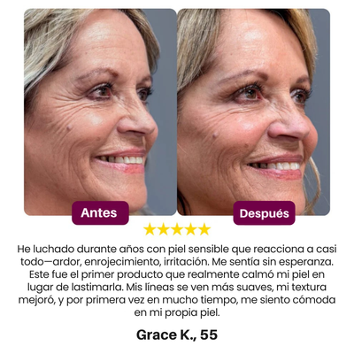 [Dr.Melaxin Oficial] Bálsamo Multi-Uso de Calcio + Parches de Ojos Gratis