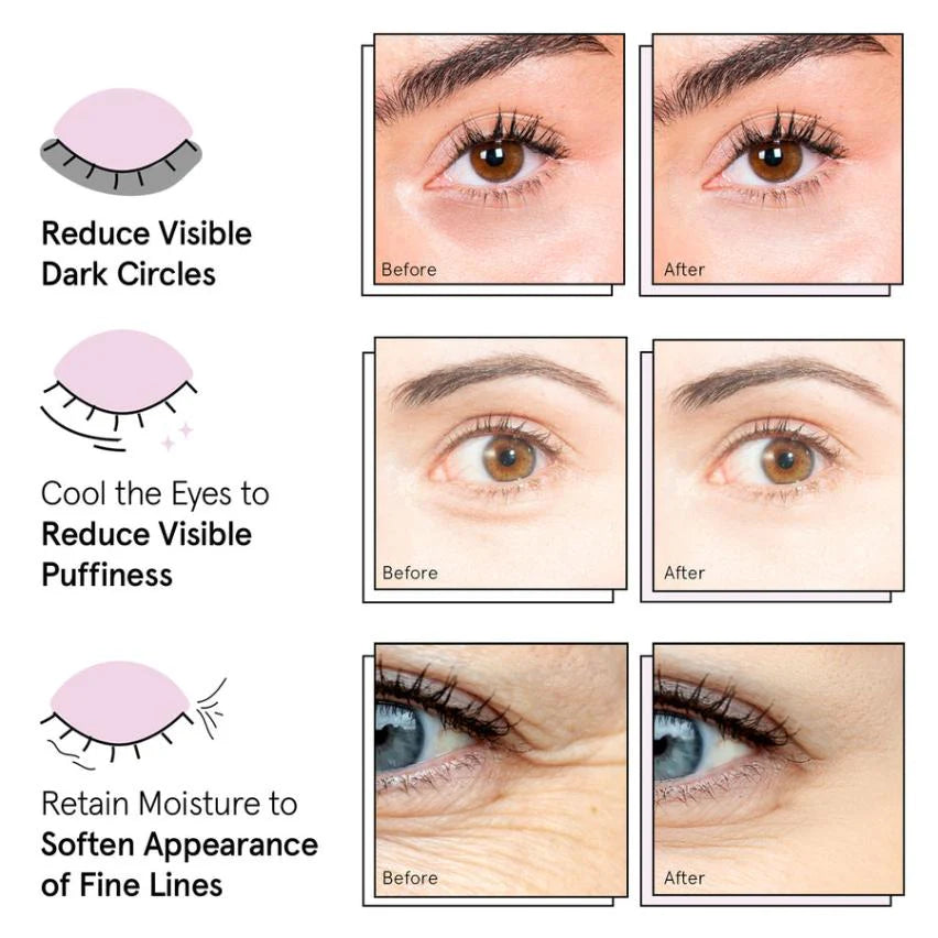 PARCHE REGENERATIVO PARA OJOS CON HIDROGEL DE COLÁGENO Y PÉPTIDO (60 uds.)