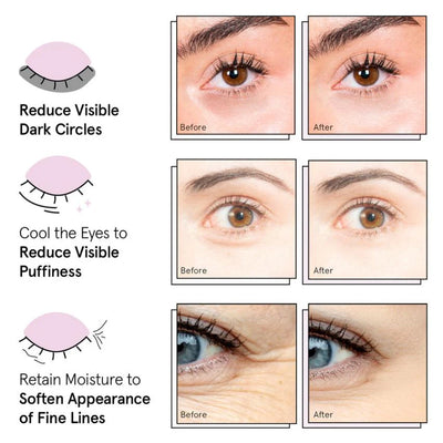 PARCHE REGENERATIVO PARA OJOS CON HIDROGEL DE COLÁGENO Y PÉPTIDO (60 uds.)